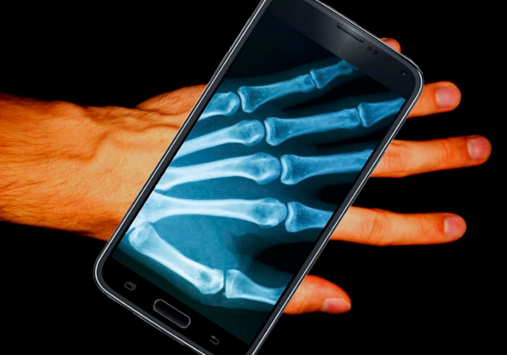 Applications that Turn your cell phone into a Free X-ray