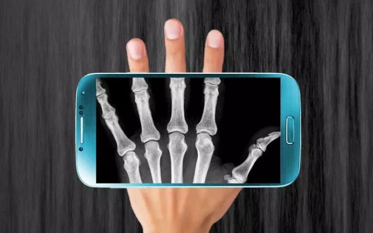 Free Apps for Taking X-rays on your Cell Phone